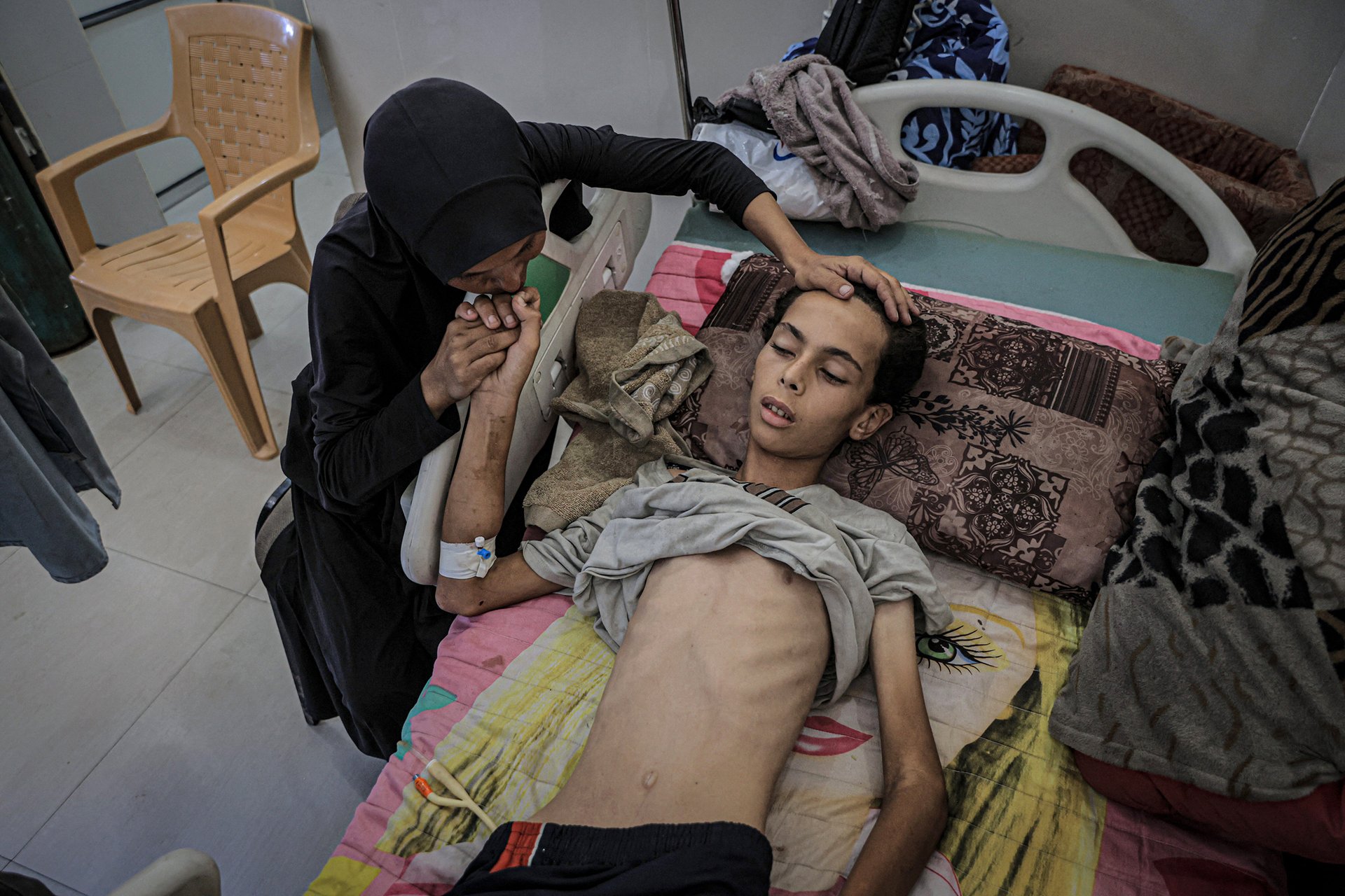 Teenager suffering from malnutrition in Gaza awaits treatment