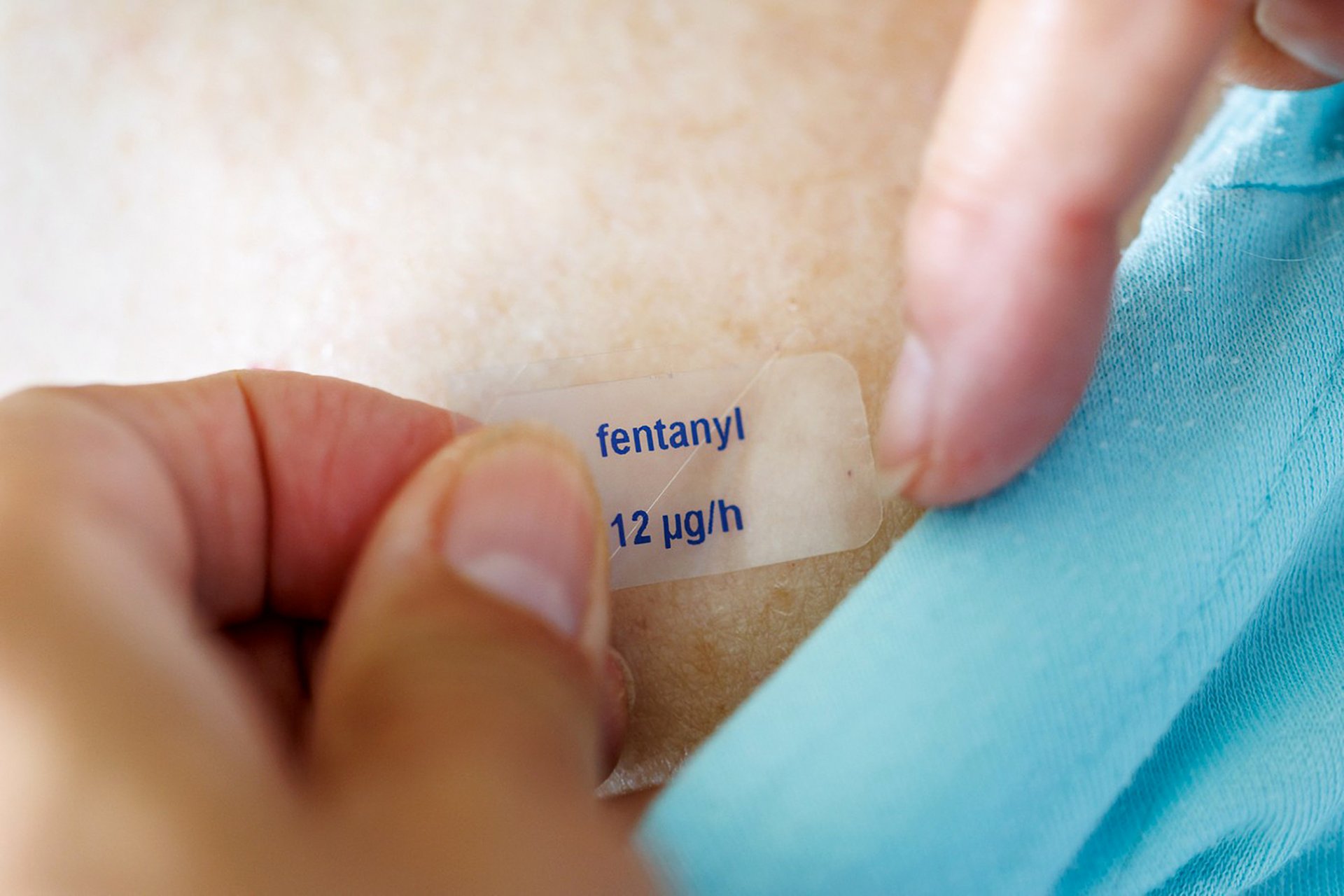 Draze koupit, nastříhat, vyvařit. (Fentanylová náplat)