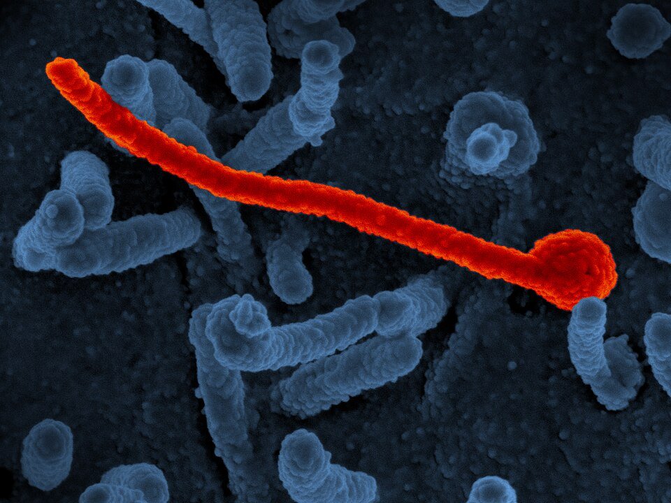 Ebola, ptačí chřipka, hantavirus, Marburg... Pomůže AI předejít příští pandemii nebo ji způsobí?